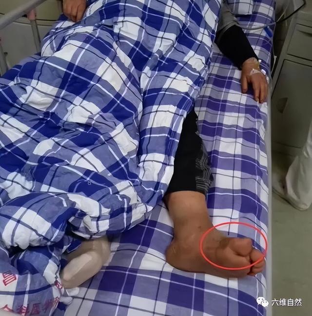 猫为什么可以跟毒蛇打架，猫和蛇打架猫不怕毒吗（重庆一只小猫叼着小毒蛇回家）