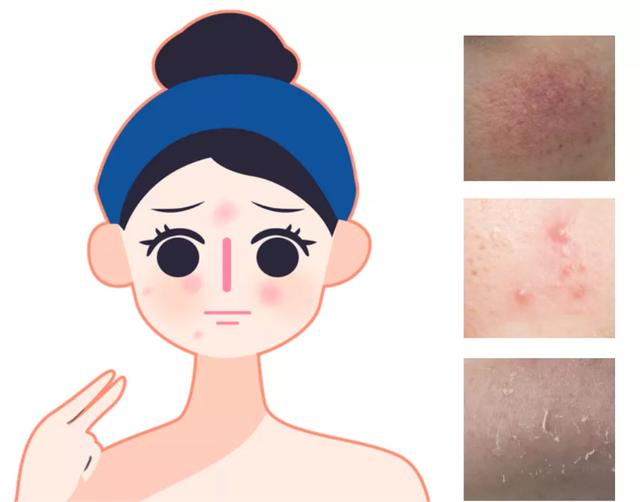 却上心头才上心头网名,却上心头才上心头微信昵称(拯救“受伤”的肌肤) 却上心头才上心头网名,却上心头才上心头微信昵称(拯救“受伤”的肌肤)