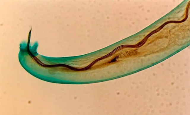 蜗牛的身体结构，蜗牛的主要身体结构和作用（在中国泛滥成灾的非洲大蜗牛）