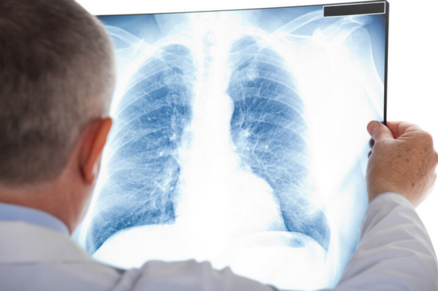 石棉纤维是什么东西，石棉纤维是什么样子的（性能优异却被多个国家禁用）