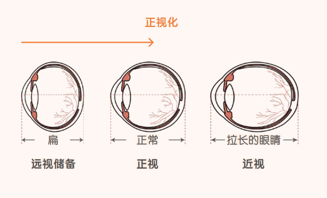 幼儿园小孩正常视力是多少,幼儿园孩子正常视力是多少(5岁孩子才08)