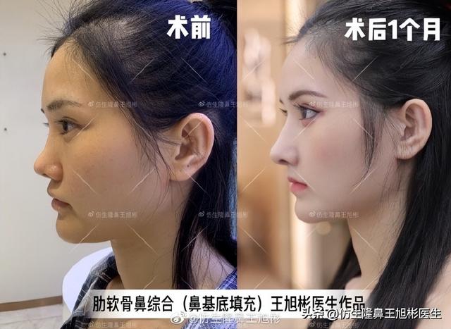 高级脸是什么意思，6种脸型不显老（“月亮脸”逆袭“高级脸”的不二法则是）