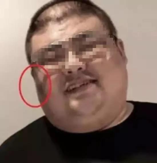 皮毒的症状图片，这6种果皮吃了会中毒（胖子脸颊或者脖子出现黑斑）