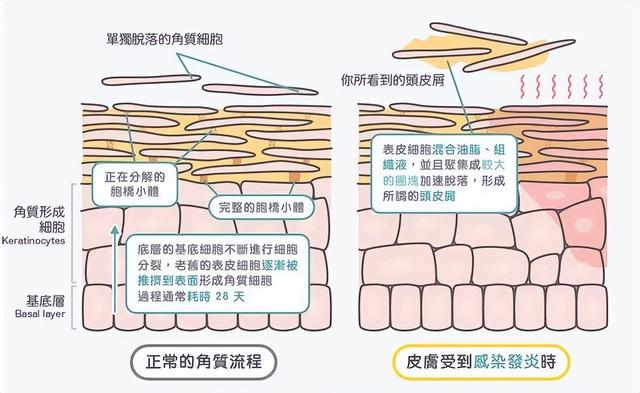 干发帽的正确戴法，干发帽怎么戴（保养头发的方法）