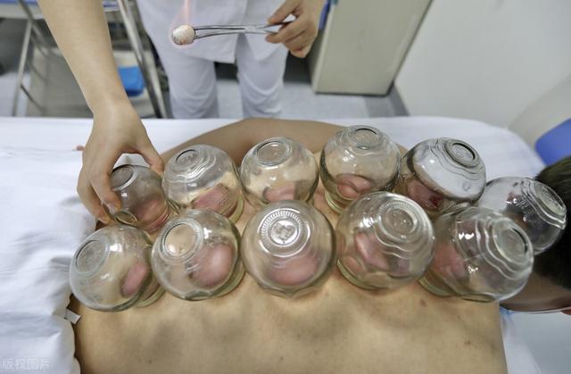 拔火罐颜色，拔火罐颜色越深湿气越重吗（拔罐，你拔出了什么）