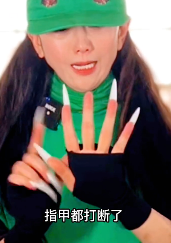 杨丽萍40多年没有指甲，曾为其每年花18万