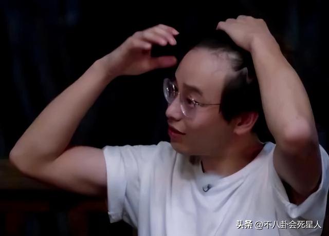 杨幂的发际线是什么样的，14位明星增发妙招