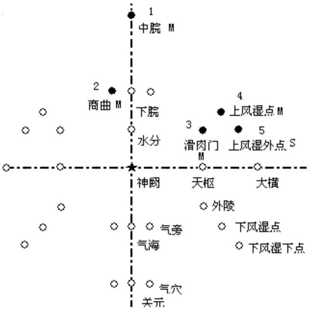 针灸减肥腹部八针法图片，什么是腹部针炙减肥（腹针疗法及常用腹针处方介绍）