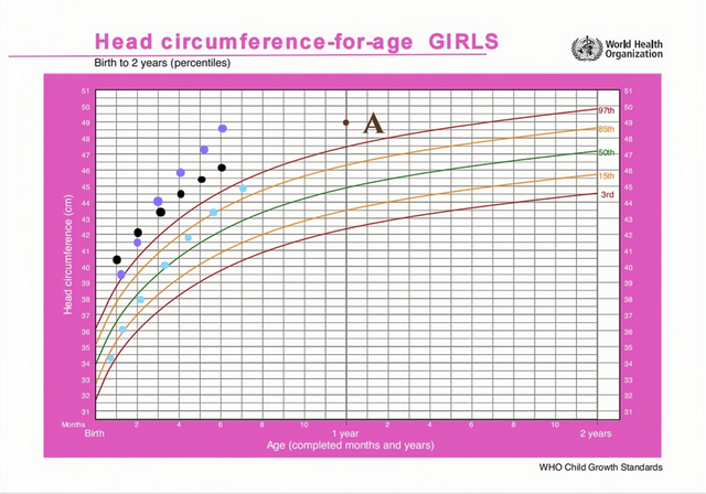 婴儿头型后脑勺标准图，婴儿头型后脑勺标准（是不是喝的奶粉有问题）