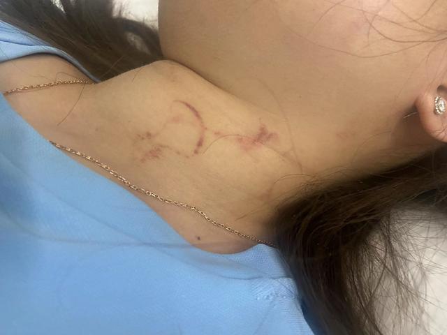 柬埔寨血奴事件，柬埔寨血奴事件发生原因（90后福建女子柬埔寨遭性侵殴打）