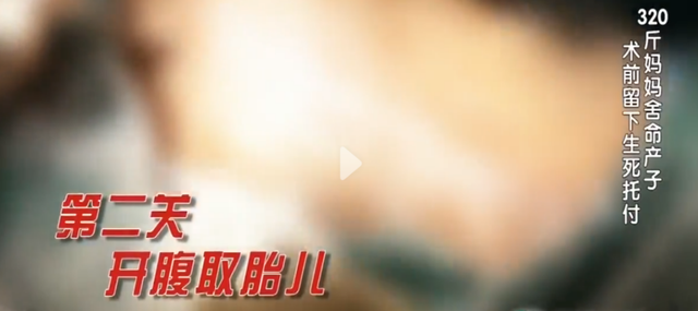 怀孕七个月胎儿图，怀孕7个月的胎儿什么样子（医生扒开脂肪层抱出7斤重的男婴）