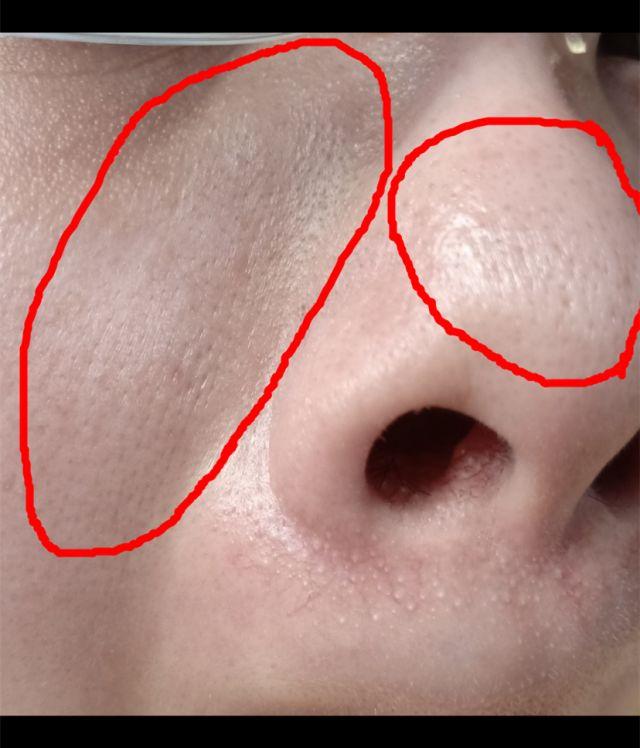 脸部能天天热敷吗，热敷脸有哪些功效与作用（面膜可以天天敷吗）