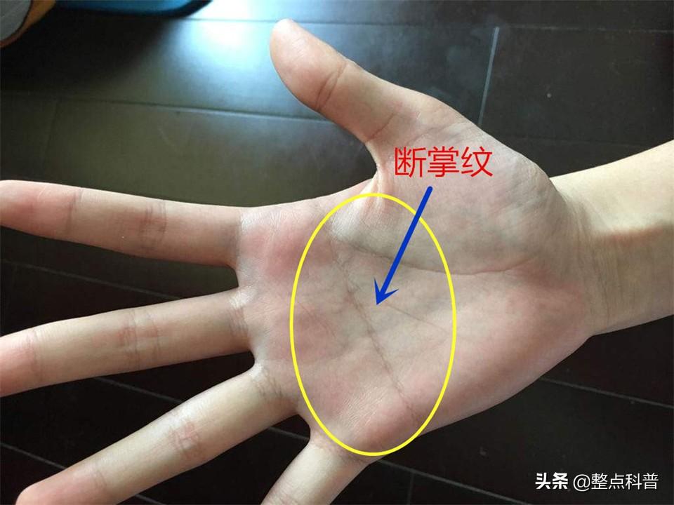 相學中雙手斷掌有何說法,男兒斷掌千斤兩 相學中雙手斷掌有何說法,男兒斷掌千斤兩