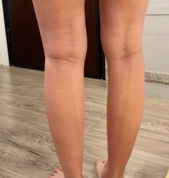 孕后期手肿要怎么缓解，孕期如何缓解手肿（42岁女星怀孕8个月手指关节疼）