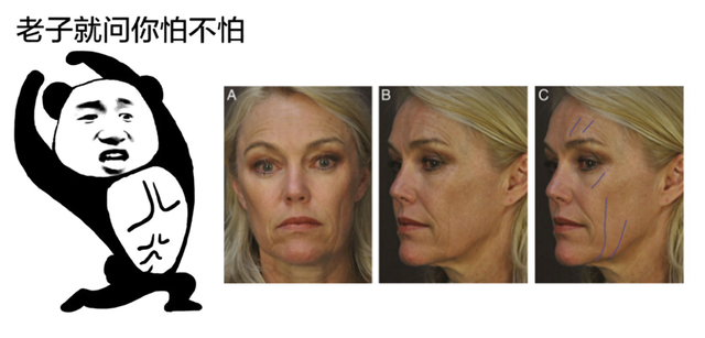 内衣跑杯的原因，内衣穿着穿着就跑杯了的原因有哪些（伤颈变丑还越睡越累）