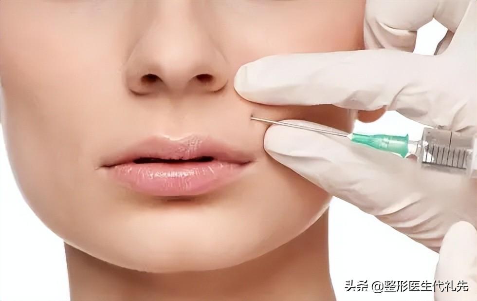 有必要时,可以在唇周的表情肌上适量打一点肉毒素,来控制表情纹我们都