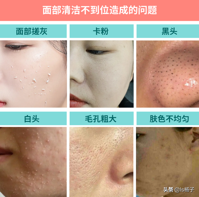 面部清洁的基本步骤，日常清洁面部的方法（脸部太脏自己在家怎么做深层清洁脸部）