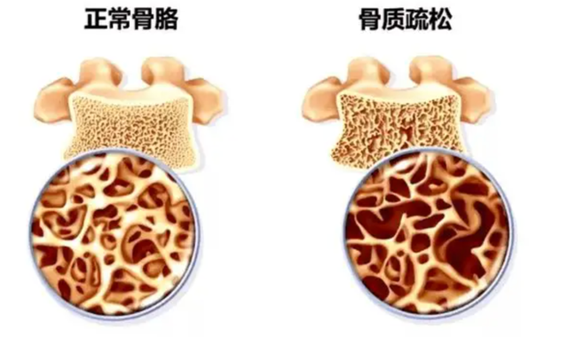 维生素a的作用和功效及副作用，维生素a的作用和功效（维生素A过量会发生毒性反应）