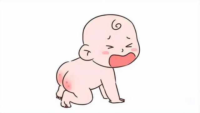 宝宝红屁股图片，宝宝出现了红屁股（宝宝出现红屁股，宝妈该怎么做）