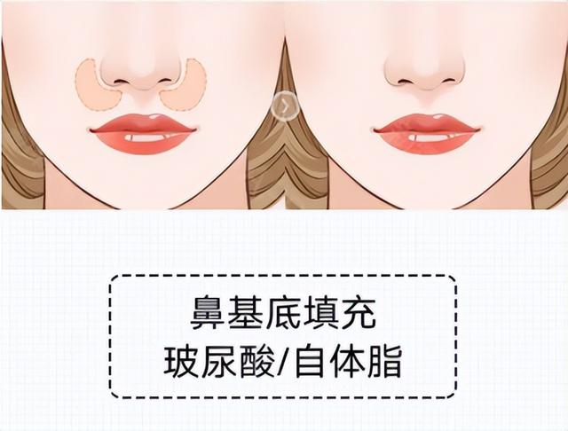 面部24个美容部位，面部常用美容穴位名称及作用（面部轮廓整形涉及哪些部位）