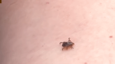 蜱虫是什么，可致命：夏季出游当心此虫（蜱虫是什么样的毒虫）