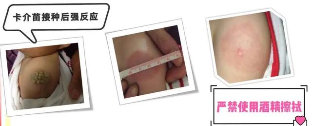 卡介苗的接种时间和意义是什么，卡介苗接种的主要作用是什么?(6分)（宝宝出生后为什么要接种乙肝疫苗和卡介苗）