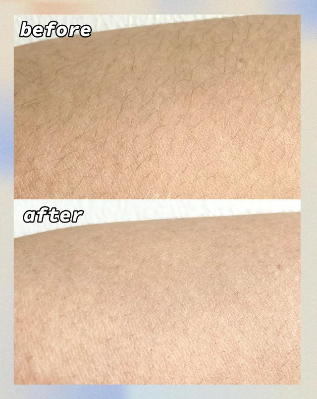 薇婷脱毛膏正确使用方法，薇婷脱毛膏正确使用方法图解（5款爆火脱毛产品真人实测）