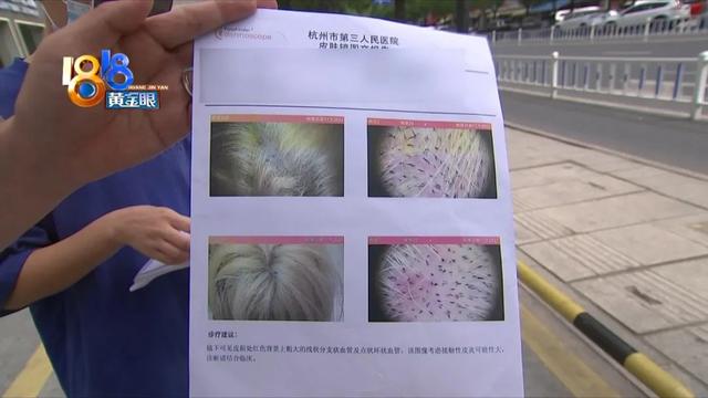 梦到剪头发是什么征兆女性，女人梦见别人剪头发是什么征兆（漂染后“齐根剪”）