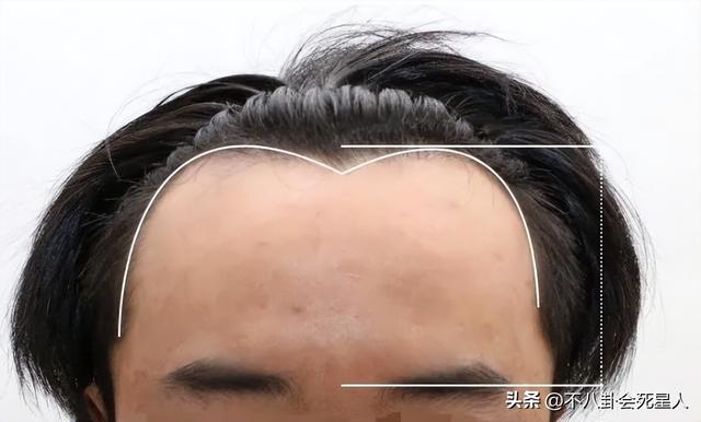 杨幂的发际线是什么样的，14位明星增发妙招