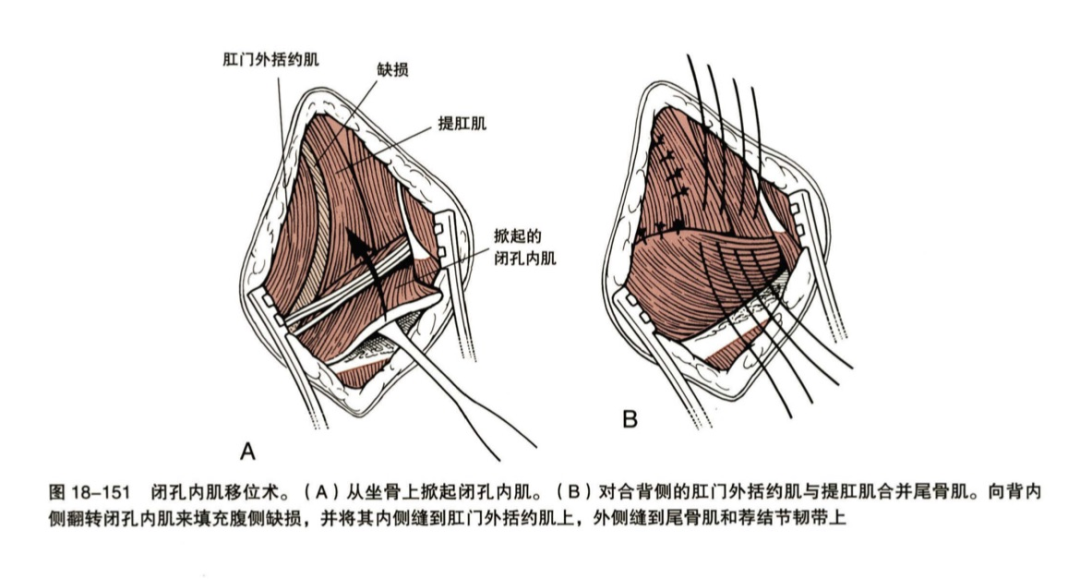 狗会阴疝手术多少钱 狗狗得了阴疝手术失败怎么办