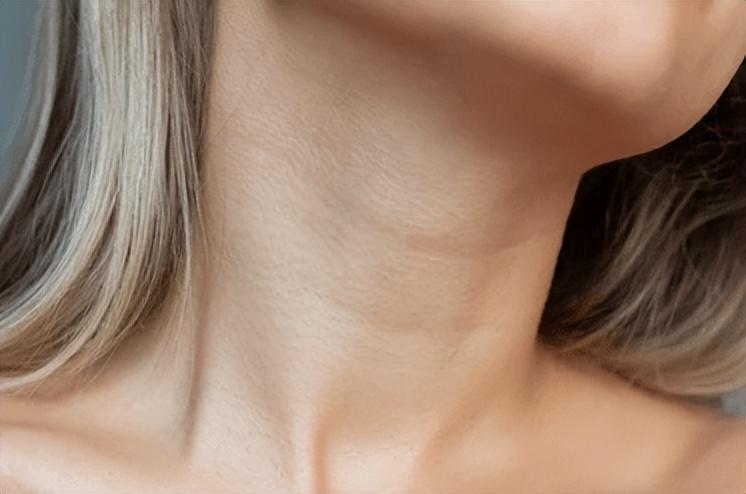 如何去颈纹最有效，消除颈纹的六个好方法