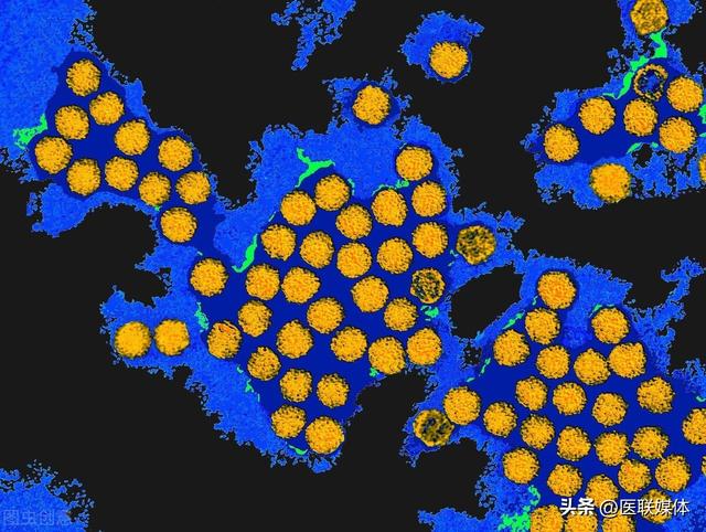 女生裸睡好还是穿内裤子好，女性裸睡好还是穿着内裤睡好（女性裸睡，要不要穿内衣和内裤）