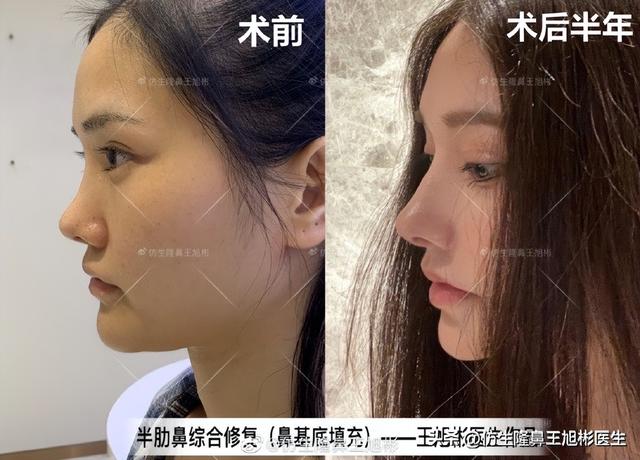 高级脸是什么意思，6种脸型不显老（“月亮脸”逆袭“高级脸”的不二法则是）