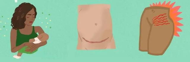 身体有异味是什么原因女性，女人身上异味重原因（都是从生完娃开始的）