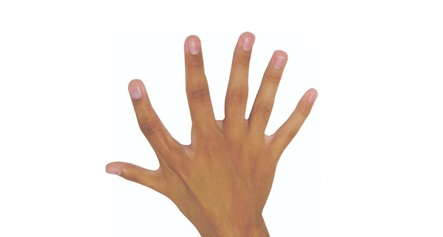 五个手指的是什么，五个手指发麻是什么原因引起的（巴西家族为自己有十二根手指感到自豪）