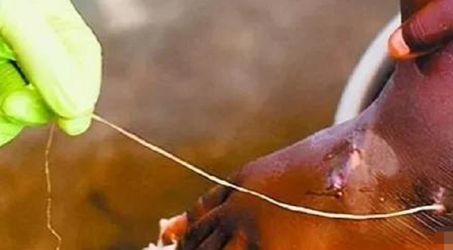 泥鳅煮多久杀死寄生虫，却被一米长寄生虫寄生（泥鳅煮多久杀死寄生虫子）