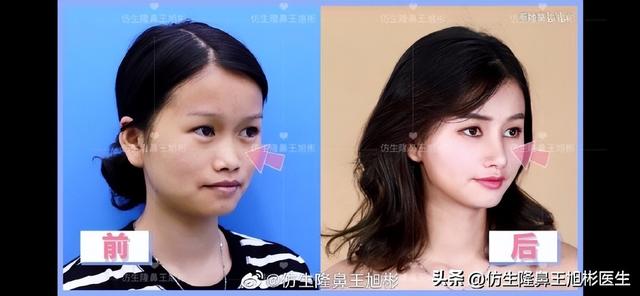 高级脸是什么意思，6种脸型不显老（“月亮脸”逆袭“高级脸”的不二法则是）