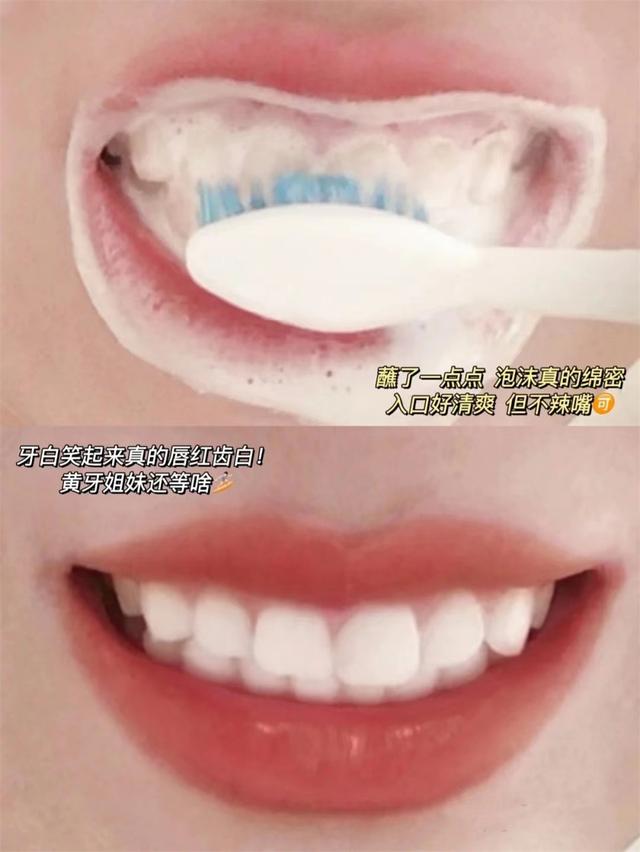 牙结石自己脱落小妙招，牙结石脱落小妙招（再臭的牙石也能自己掉）