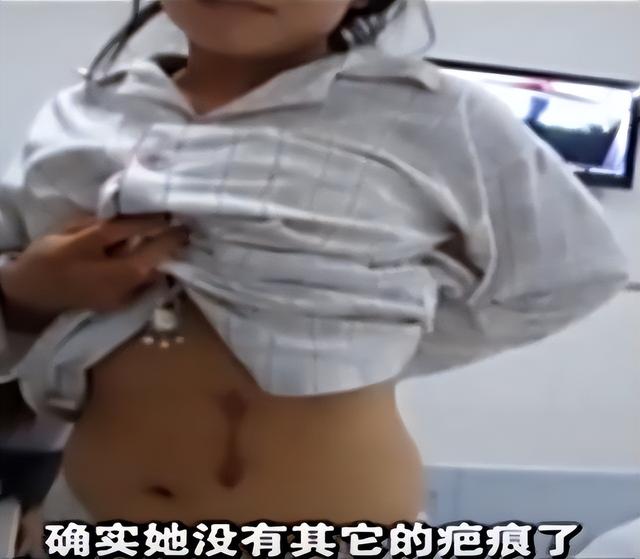 偷肾事件是假的，肾被医院偷了就真的吗（陕西女子体检发现左肾丢失）