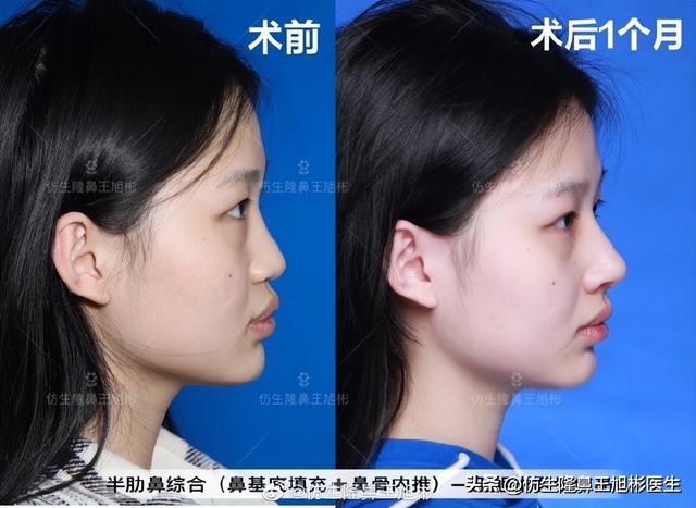 高级脸是什么意思，6种脸型不显老（“月亮脸”逆袭“高级脸”的不二法则是）