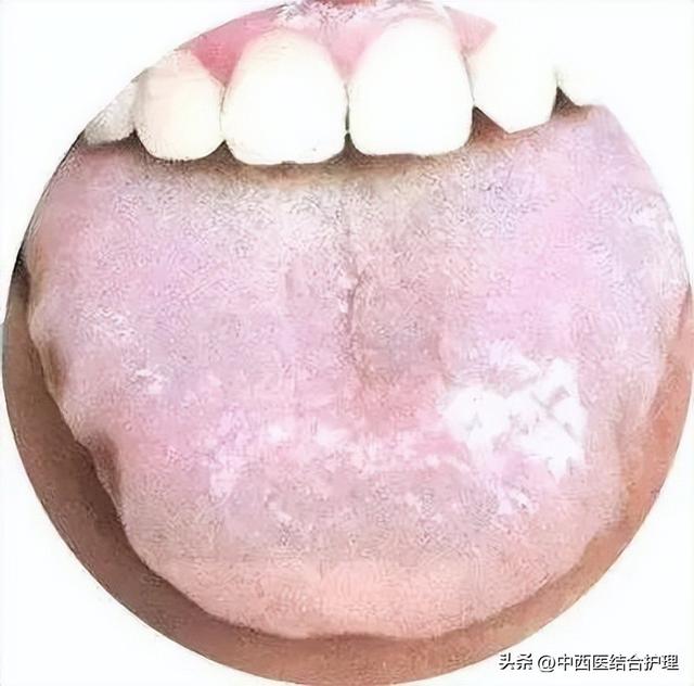 为什么很多人觉得舌尖3不如前两部好看了，舌尖3为什么评分那么低（舌头出现的各种症状）