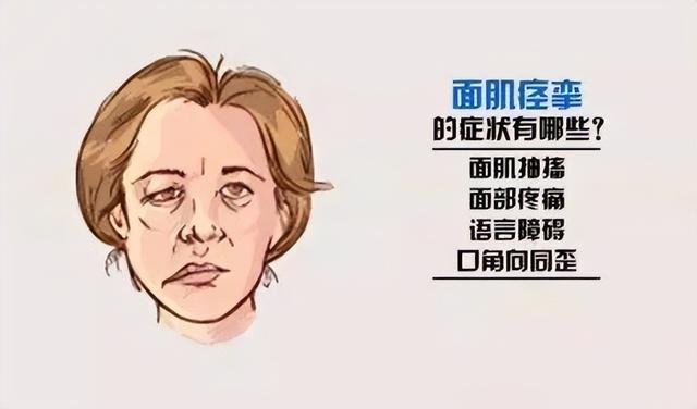 2,眼瞼不停抽動,竟是面肌痙攣,微創開顱術,讓40歲教師找回