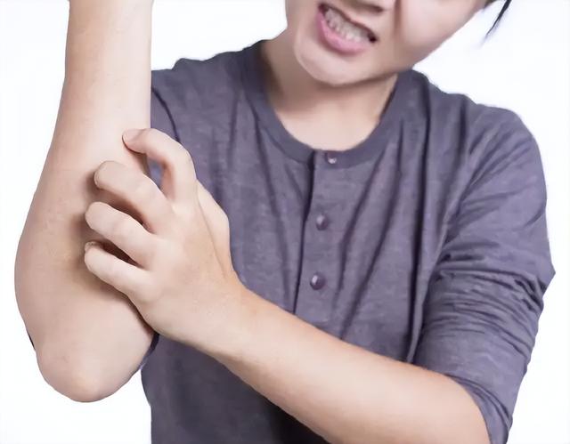 玫瑰糠疹吃什么药，玫瑰糠疹吃什么药好使（“万能皮肤药”炉甘石洗剂）