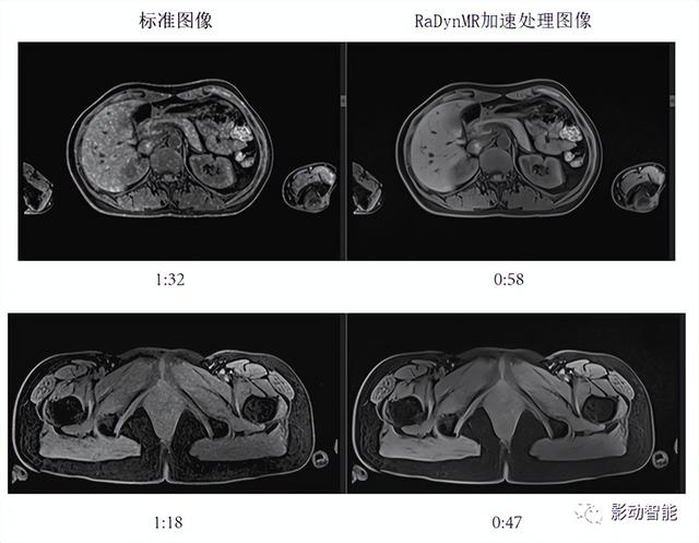 孕期检查时间，孕妇做检查时间表（备孕与妊娠期间进行影像检查应注意哪些事项）