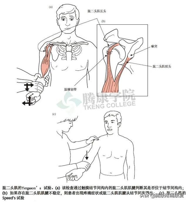 biceph，肩关节的特殊检查（bicep curl）