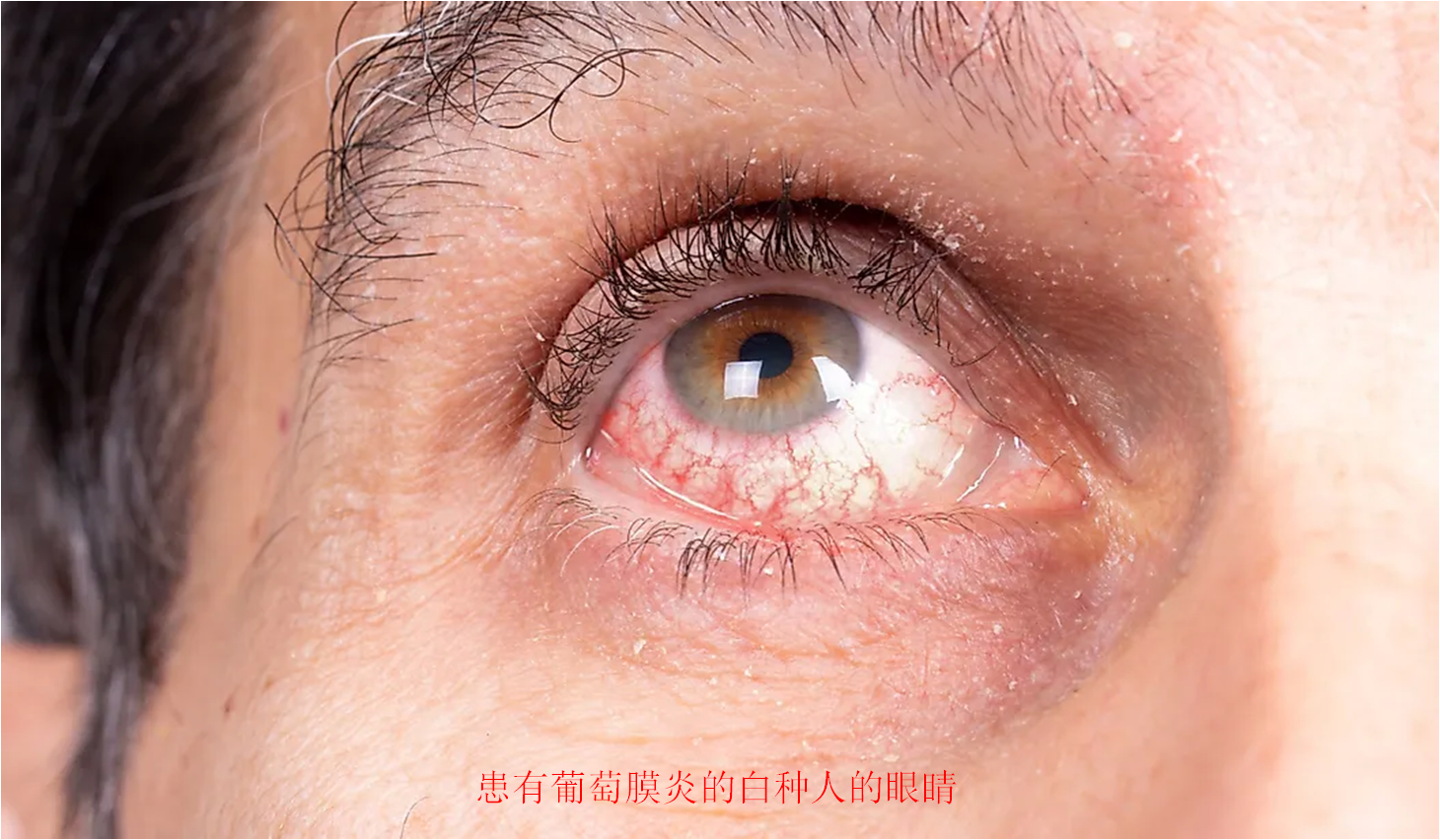 什么颜色对眼睛好，哪些颜色对眼睛好（各种眼睛颜色的人口比例是多少）