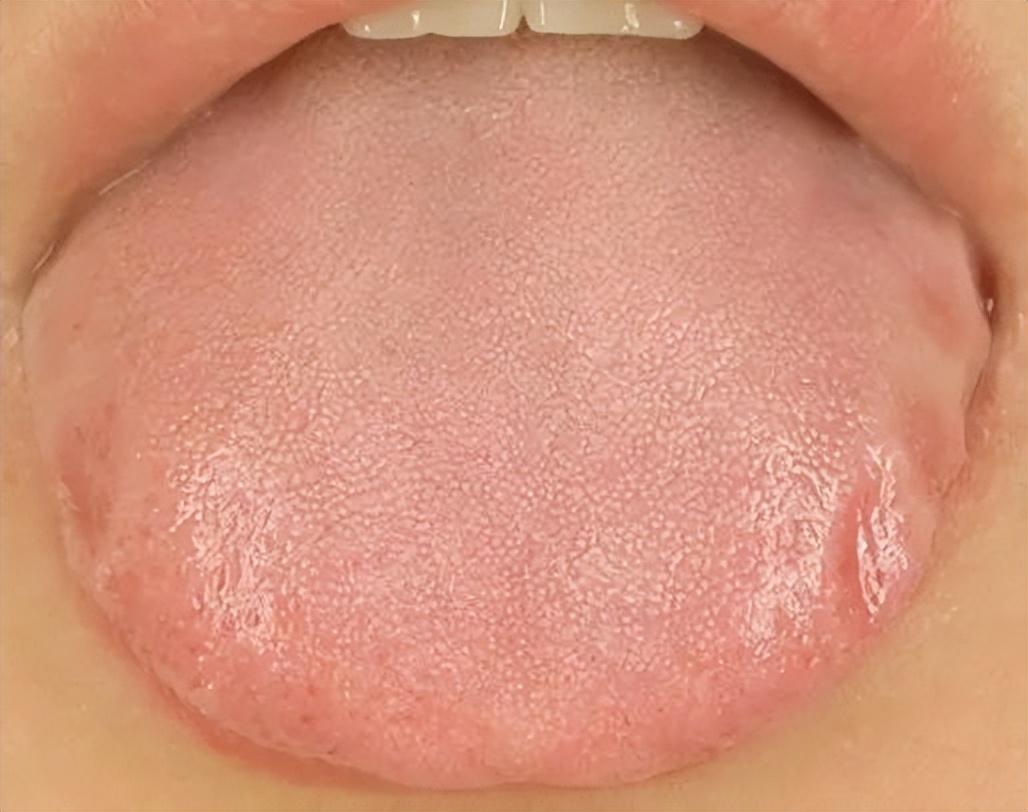 人体"照妖镜",看舌头就能分辨7种体质!看看你是哪一种?-