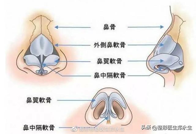 鼻头缩小术千万别做，鼻缩小手术千万别做（肉鼻子做了鼻头缩小结果越“缩”越“大”）