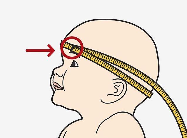 婴儿头型后脑勺标准图,婴儿头型后脑勺标准(是不是喝的奶粉有问题)