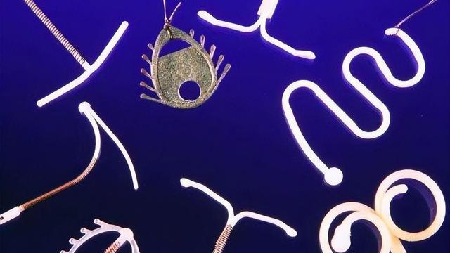 人流手术前要准备什么，人流手术前要准备什么东西（节育环一直不取出来）